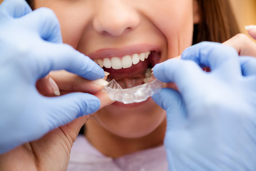 orthodontist-with-invisalign-patient-825×551